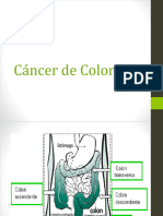 Cáncer de Colon