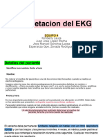 Interpretacion Del EKG