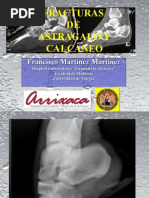 Clase de Fracturas de Calcaneo y Astragalo