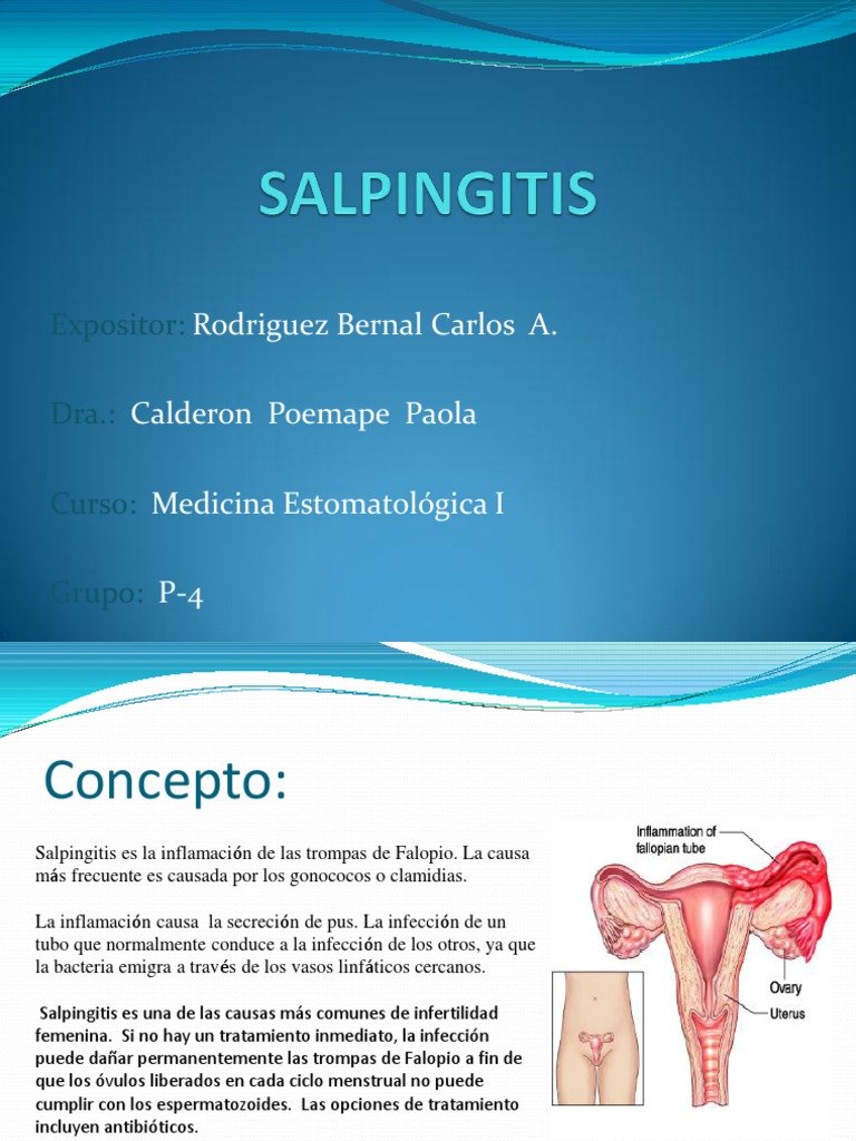 Salpingitis Anatomia Sexual Salud Pública | Free Download Nude Photo ...