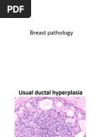 Breast Lesions Pic For Board