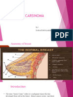 Brest Carcinoma