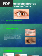 Dacriocistorrinostomía Endoscópica Orl Yessica Checnes Espilco