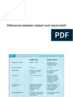 Differences Between Implant and Nature Tooth