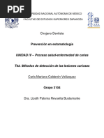 Métodos de Detección de Lesiones Cariosas