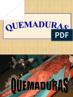 Manejo de Quemados