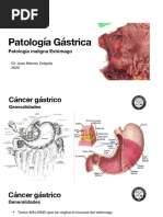 Cancer Gastrico 22