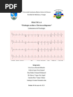 Electrocardiograma Practica 6