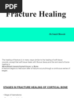 Fracture Healing