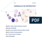 Formas Anormales de Eritrocitos