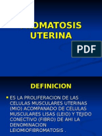 Miomatosis Uterina