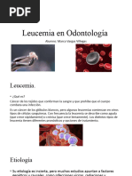 Leucemia en Odontología