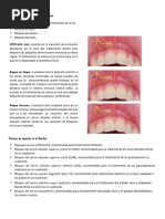 Tecnicas Anestesicas