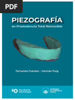 Piezografía en Prostodoncia Total Removible