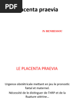 Placenta Preavia 2022