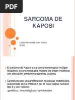 Sarcoma de Kaposi