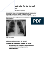 ¿Qué Muestra La RX de Torax?