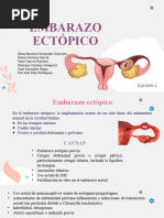 Embarazo Ectopico Completo