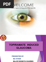 Topiramate Induced Glaucoma