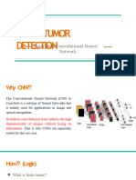 Brain Tumour Detection