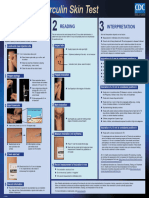 Mantoux TB Skin Test