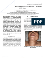 Mandibular Mass Revealing Vesicular Thyroid Carcinoma A Case Report