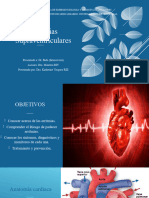 Arritmias Cardiacas