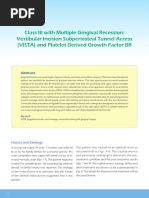 Class III With Multiple Gingival Recession: Vestibular Incision Subperiosteal Tunnel Access (VISTA) and Platelet-Derived Growth Factor BB