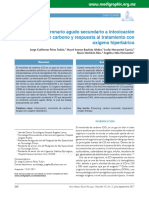 Síndrome Coronario Agudo Secundario A Intoxicación Por Monóxido de Carbono y Respuesta Al Tratamiento Con Oxígeno Hiperbárico