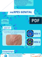 Herpes Genital