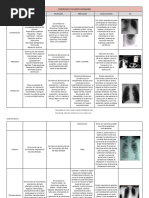 Síndromes Pulmonares