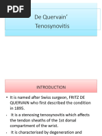 Tenosynovitis