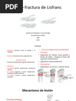 LXFX de Lisfranc