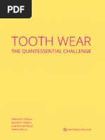 Tooth Wear