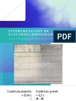 Electrocardiograma