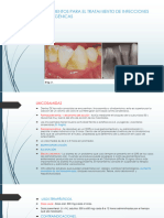 Medicamentos de Las Infecciones Odontogénicas