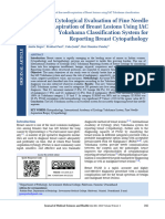 Cytological Evaluation of Fine Needle Aspiration of Breast Lesions Using IAC Yokohama Classification System For Reporting Breast Cytopathology