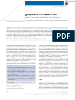 J Paediatrics Child Health - 2012 - Azam - Missed Congenital Hypothyroidism in An Identical Twin