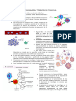 Fisiopatologia de La Tuberculosis Pulmonar