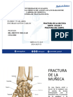 Fractura de La Muñeca