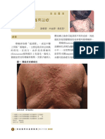 Urticaria (家庭醫業)