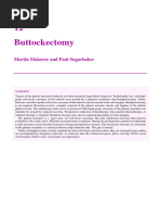 Buttockectomy