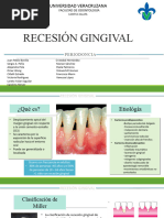 Recesión Gingival Clase Perio