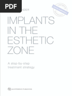 Extract - 13381 - Grunder - Implants in The Esthetic Zone