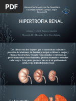 Hipertrofia Renal