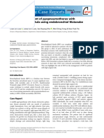 Successful Treatment of Pyopneumothorax With Bronchopleural Fistula Using The Endobronchial Watanabe Spigots