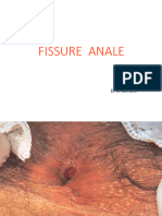 21.05.fissure Anale