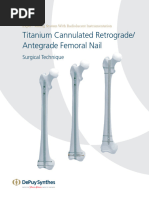 Retrograde Antegrade Femoral Nail Surgical Technique Guide