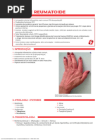 Artrite Reumatoide