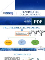 Fractura Del Cuello Femoral